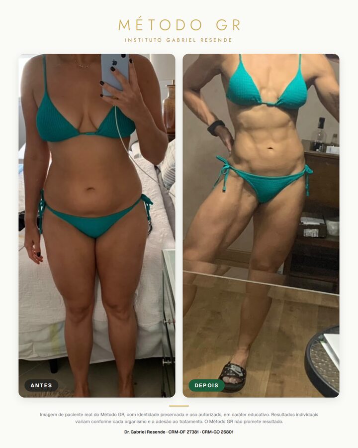 Antes e depois de paciente do Instituto (uso autorizado)