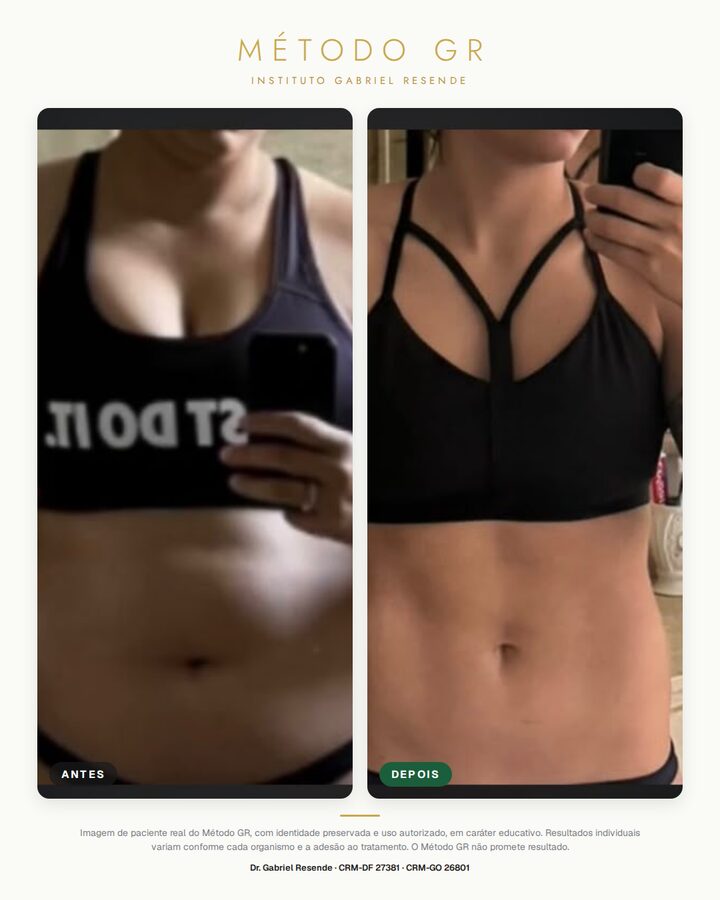 Antes e depois de paciente do Instituto (uso autorizado)