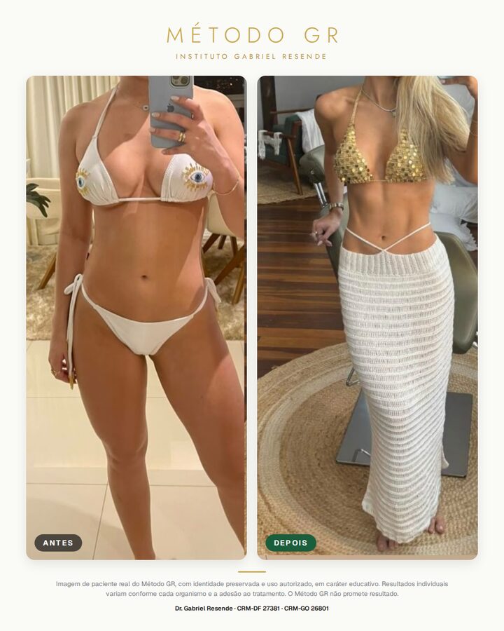 Antes e depois de paciente do Instituto (uso autorizado)