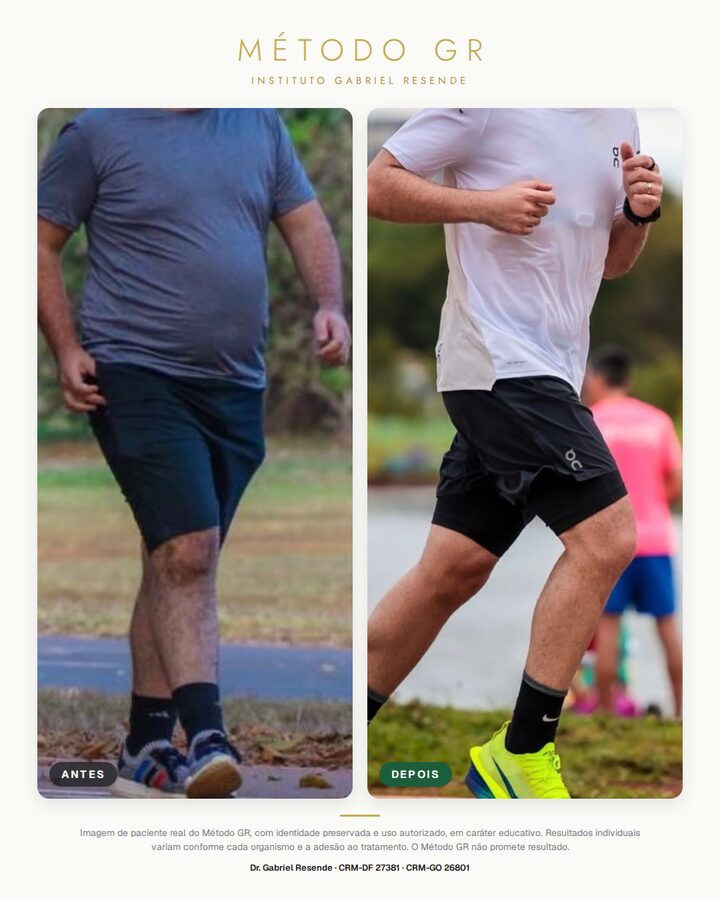 Antes e depois de paciente do Instituto (uso autorizado)