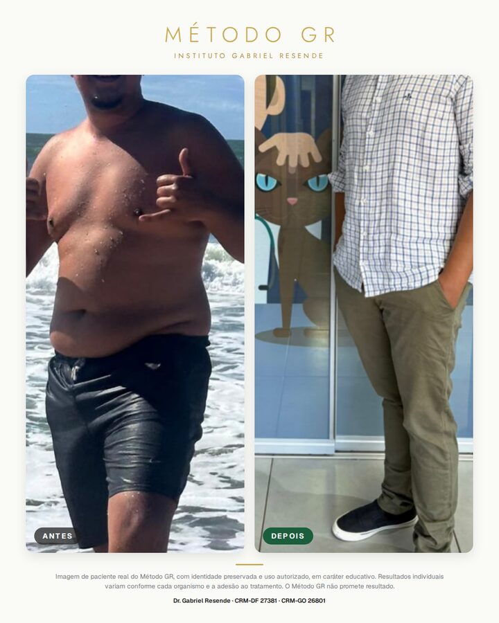 Antes e depois de paciente do Instituto (uso autorizado)