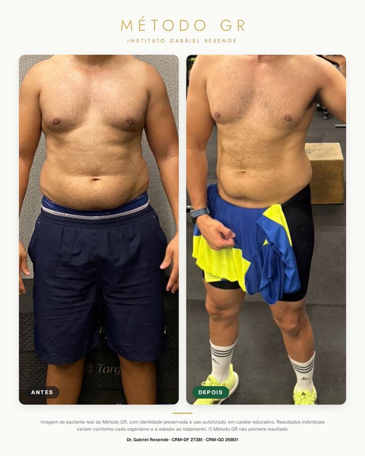 Antes e depois de paciente do Instituto (uso autorizado)
