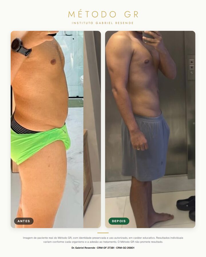 Antes e depois de paciente do Instituto (uso autorizado)