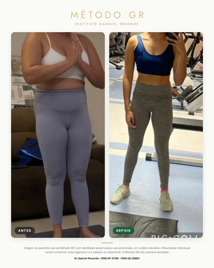 Antes e depois de paciente do Instituto (uso autorizado)
