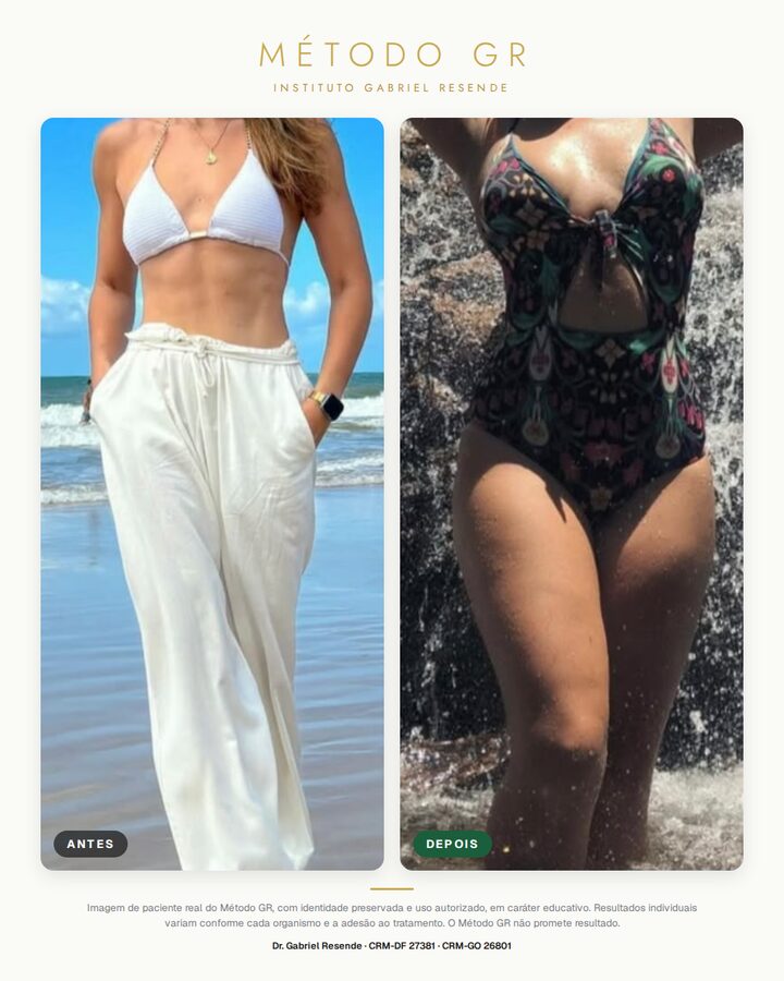 Antes e depois de paciente do Instituto (uso autorizado)