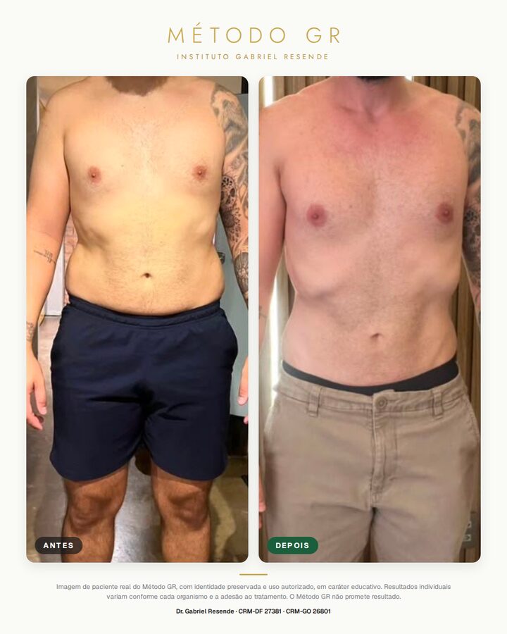 Antes e depois de paciente do Instituto (uso autorizado)
